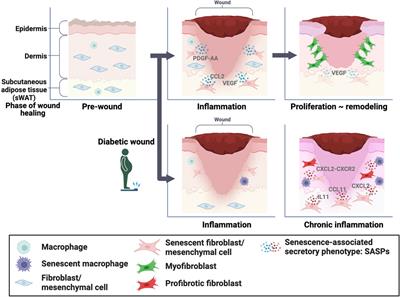Cellular senescence and wound healing in aged and diabetic skin
